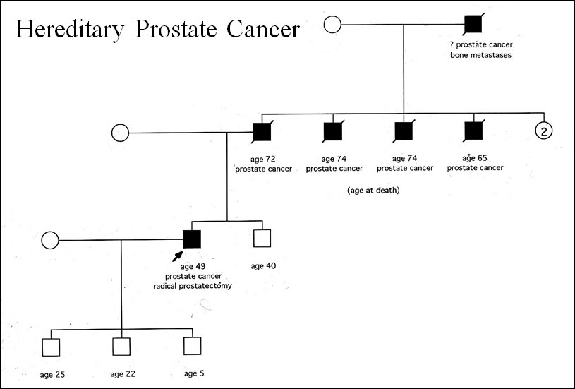 Is Prostate Cancer Hereditary